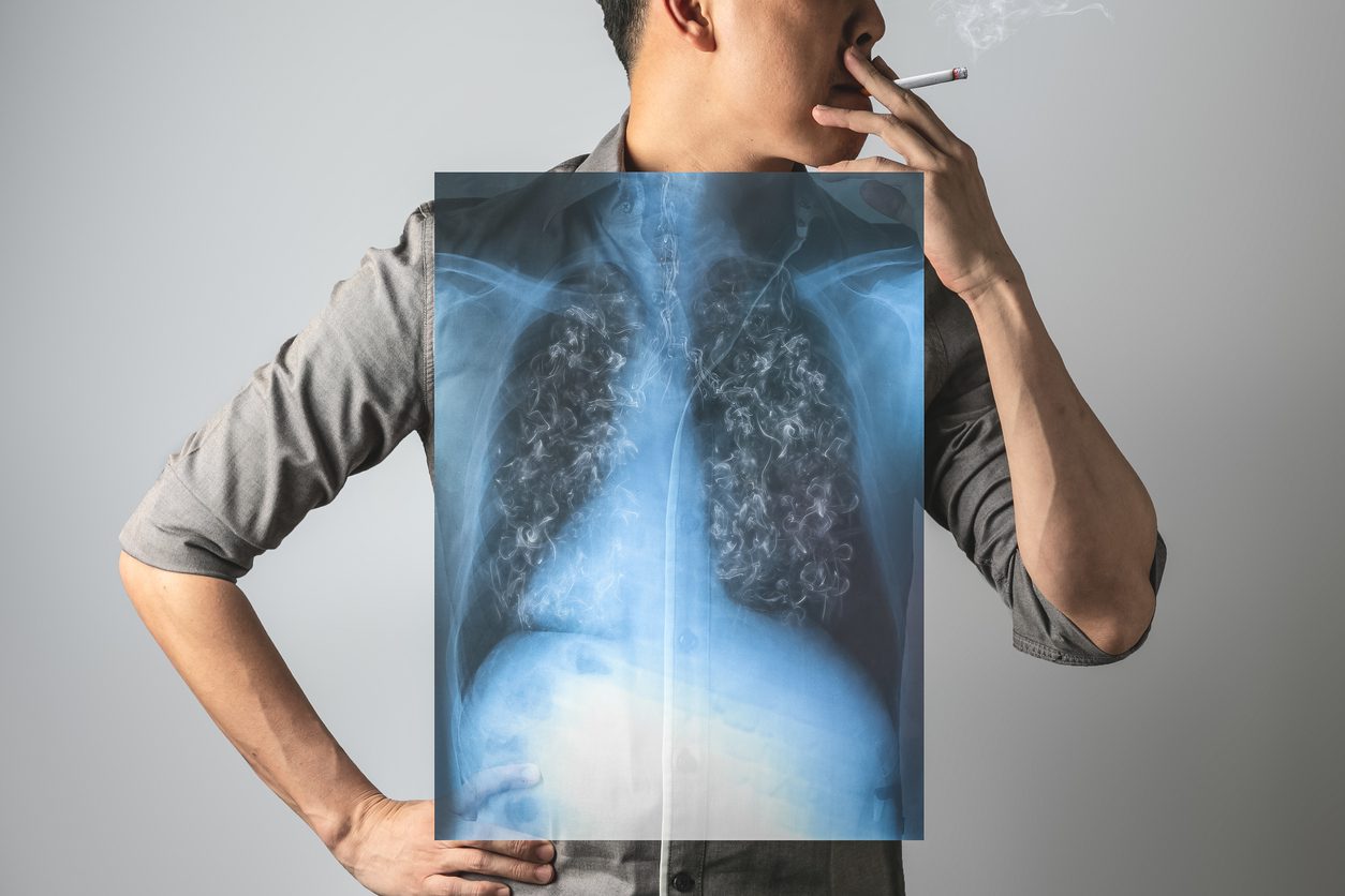 Longterm smokers show symptoms not meeting smokingrelated disease